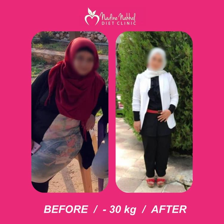 Weight loss transformation - 30kg lost