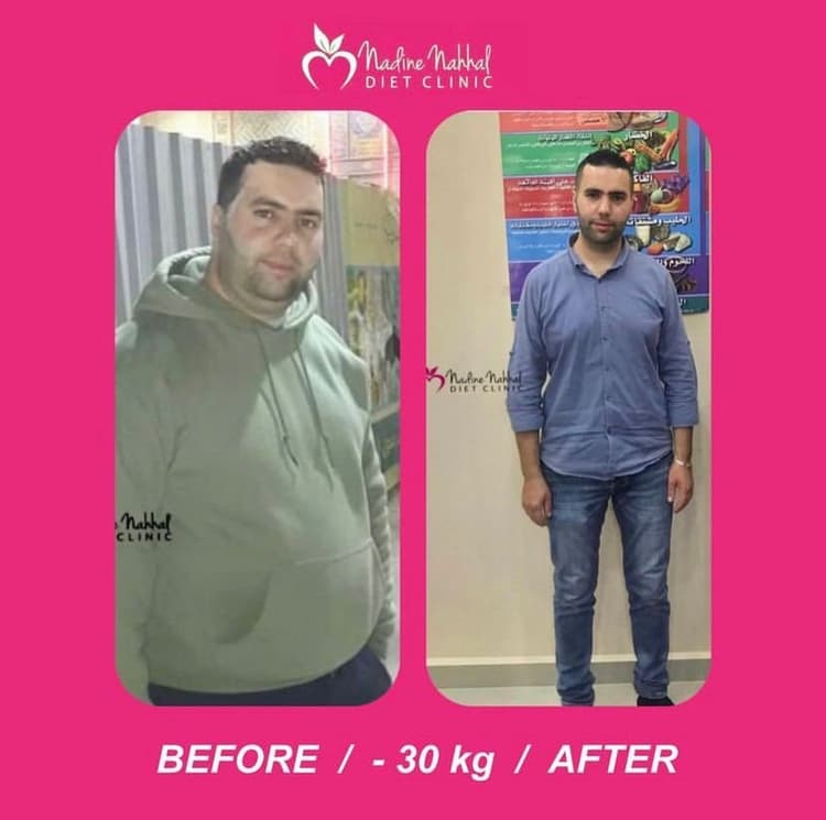 Weight loss transformation - 30kg lost