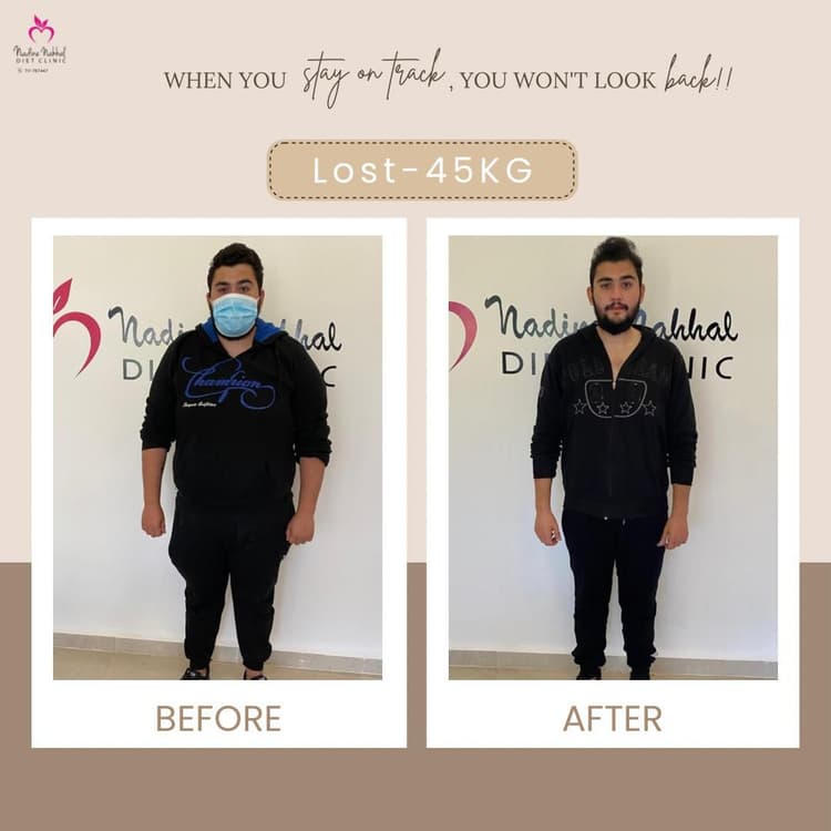 Weight loss transformation - Success Story 11