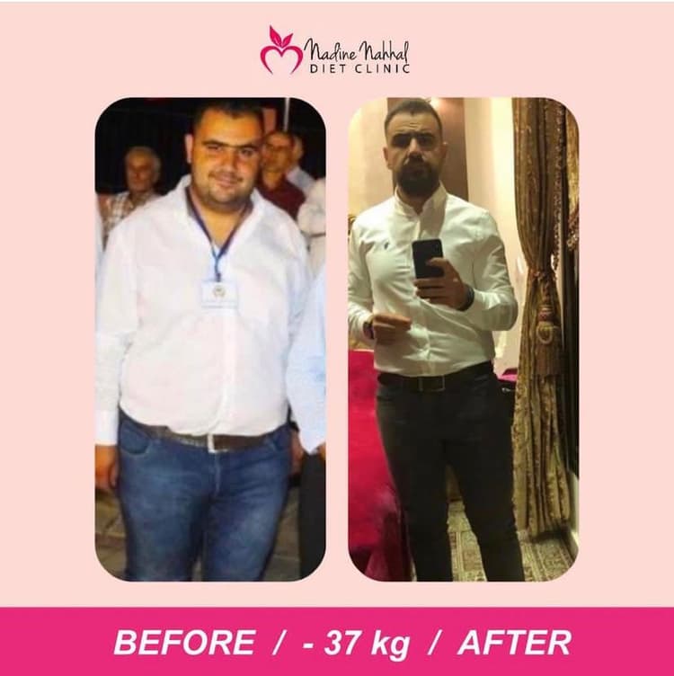 Weight loss transformation - Success Story 12