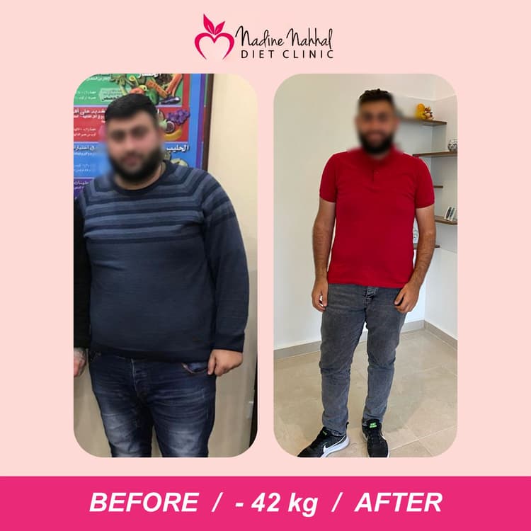 Weight loss transformation - Success Story 14