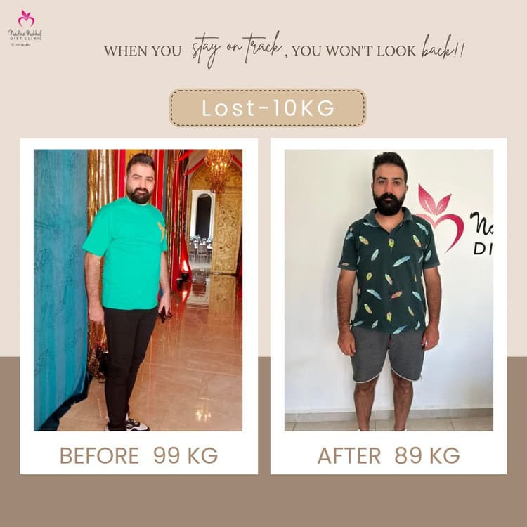 Weight loss transformation - Success Story 15