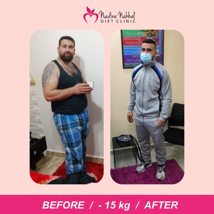 Weight loss transformation - Success Story 16