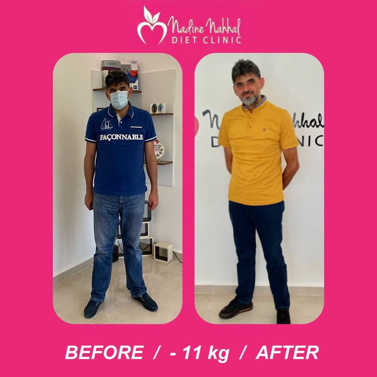 Weight loss transformation - Success Story 17