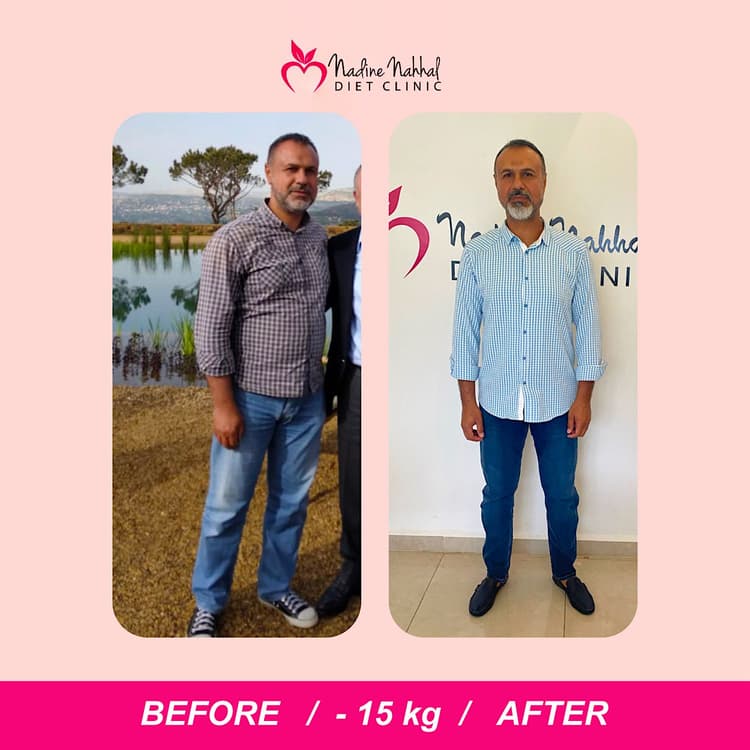 Weight loss transformation - Success Story 19