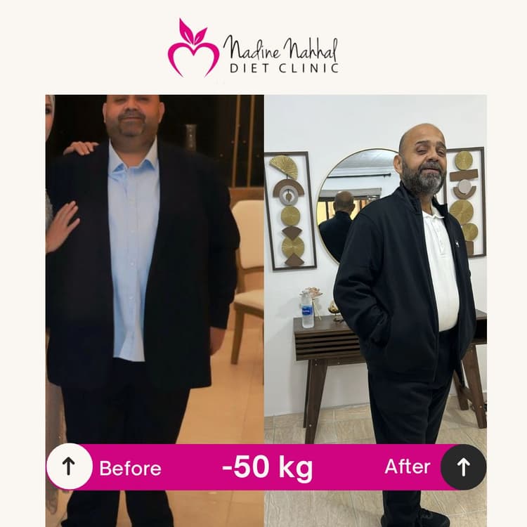 Weight loss transformation - Success Story 20