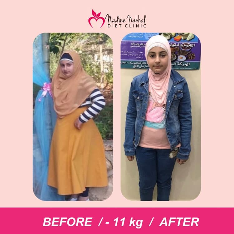 Weight loss transformation - 11kg lost